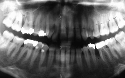 Pressen und Parodontologie (2)