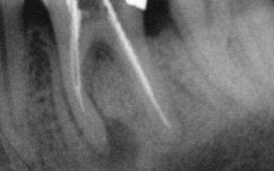 Wissenschaftliche Standortbestimmung in der Endodontie