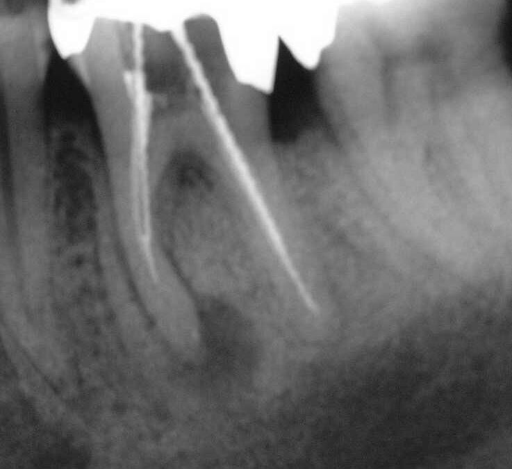 Wissenschaftliche Standortbestimmung in der Endodontie